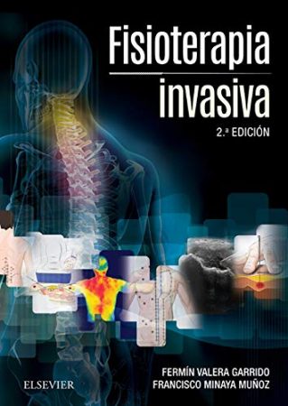 Libro Fisioterapia Invasiva Acceso Web